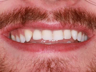 After - Brunswick Dental Practice