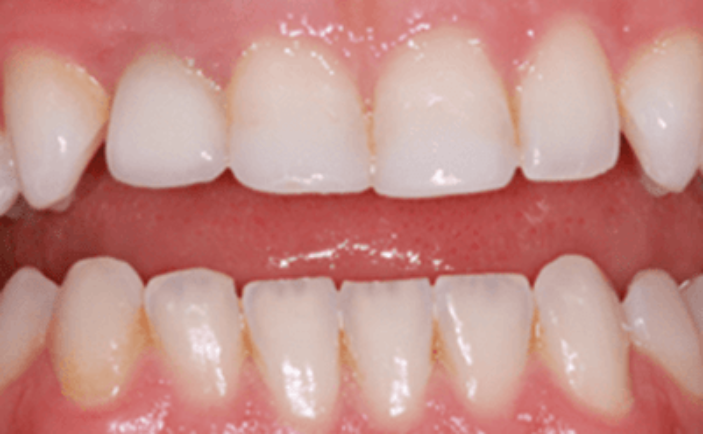 After - Brunswick Dental Practice