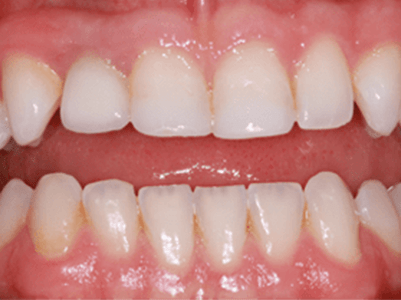 After - Brunswick Dental Practice