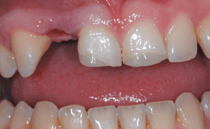 Before - Brunswick Dental Practice