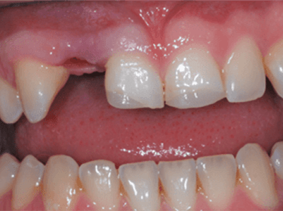 Before -Brunswick Dental Practice