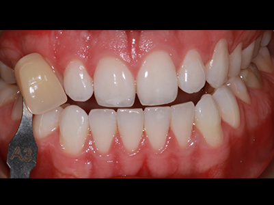 After - Brunswick Dental Practice