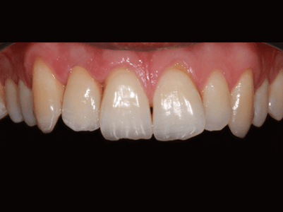 After - Brunswick Dental Practice