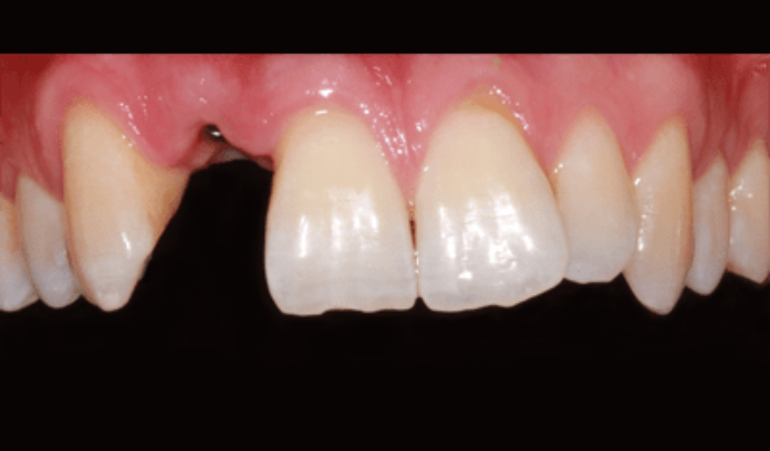 blog - Brunswick Dental