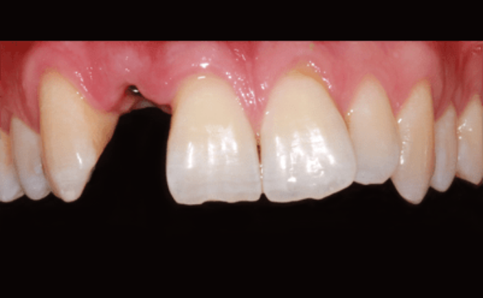 Before - Brunswick Dental Practice