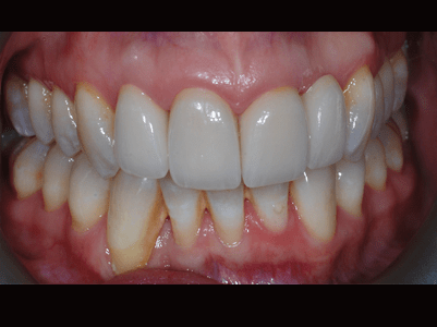 After - Brunswick Dental Practice