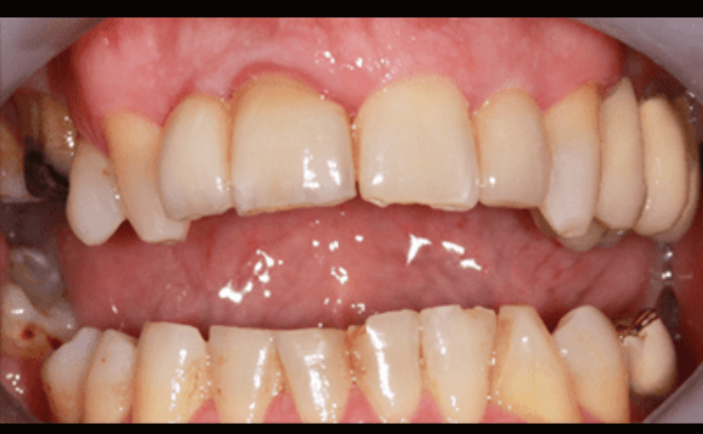 After - Brunswick Dental Practice