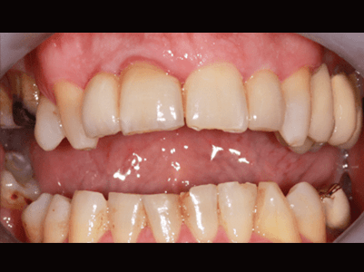 After - Brunswick Dental Practice