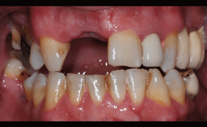 Before - Brunswick Dental Practice