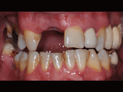 Before -Brunswick Dental Practice