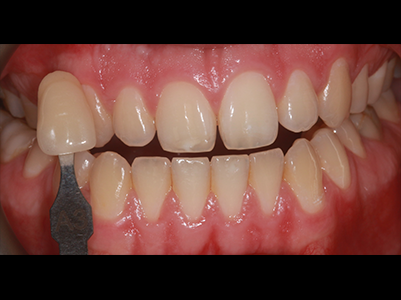 Before - Brunswick Dental Practice