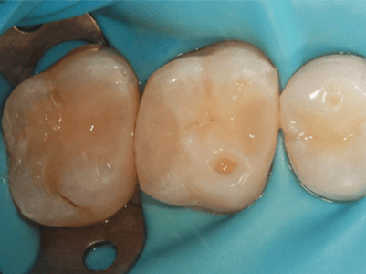 After - Brunswick Dental Practice