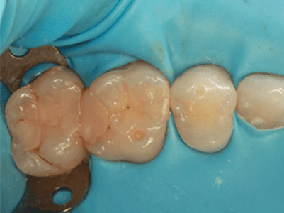 Before - Brunswick Dental Practice