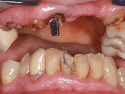 Before -Brunswick Dental Practice