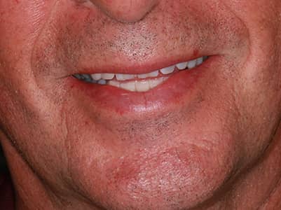 Before Face - Brunswick Dental Practice