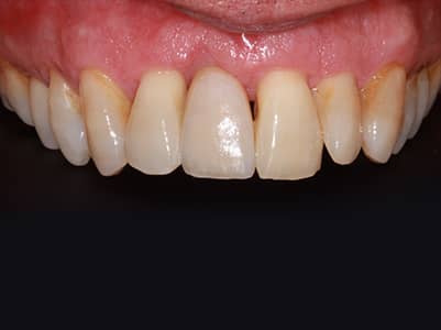 After - Brunswick Dental Practice