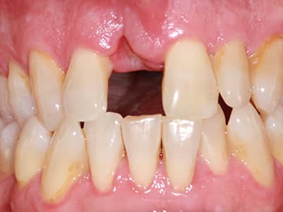 Before -Brunswick Dental Practice