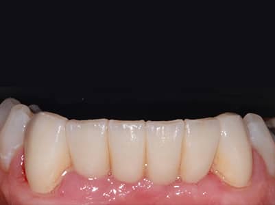 After - Brunswick Dental Practice