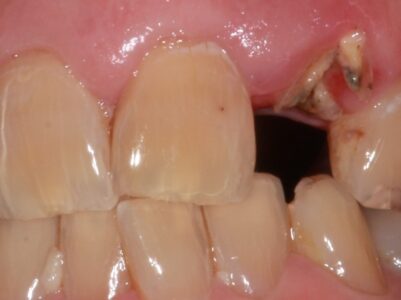 Before -Brunswick Dental Practice