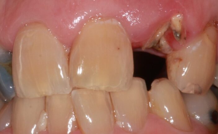 Before - Brunswick Dental Practice