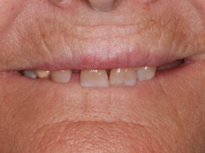 Before -Brunswick Dental Practice