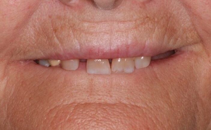 Before - Brunswick Dental Practice