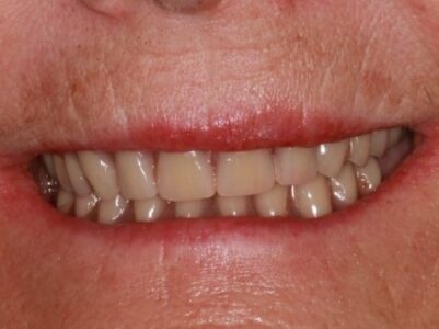 After - Brunswick Dental Practice