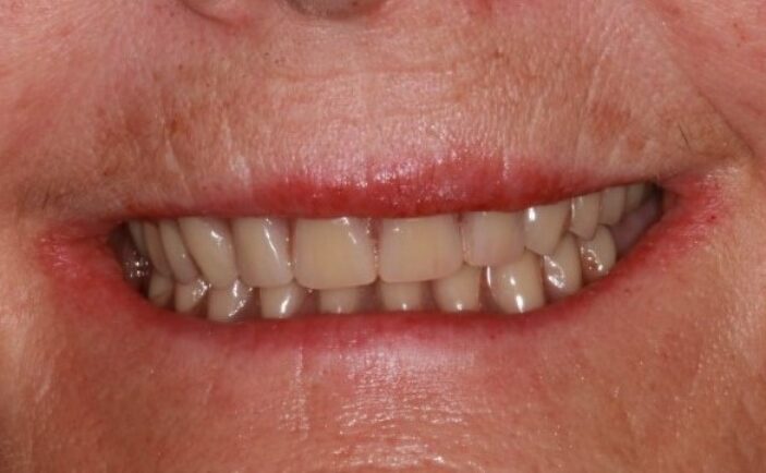 After - Brunswick Dental Practice