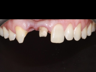 Before -Brunswick Dental Practice