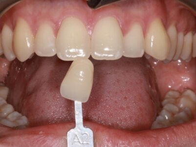 Before - Brunswick Dental Practice