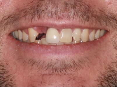 After - Brunswick Dental Practice