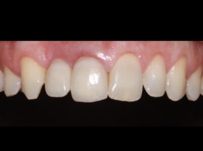 After - Brunswick Dental Practice