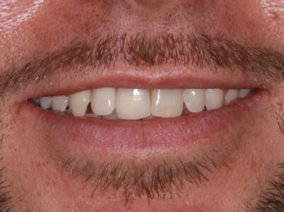 After - Brunswick Dental Practice