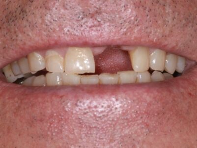 Before -Brunswick Dental Practice