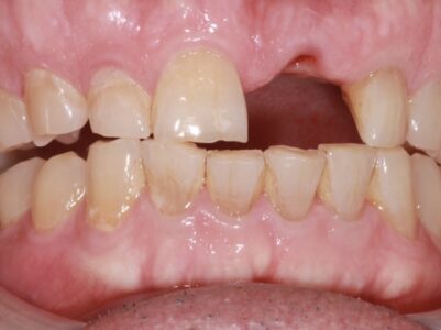 After - Brunswick Dental Practice