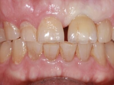 After - Brunswick Dental Practice