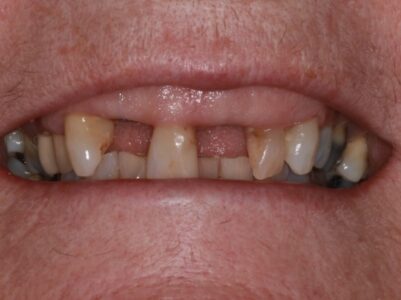 Before -Brunswick Dental Practice