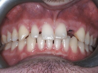 Before -Brunswick Dental Practice