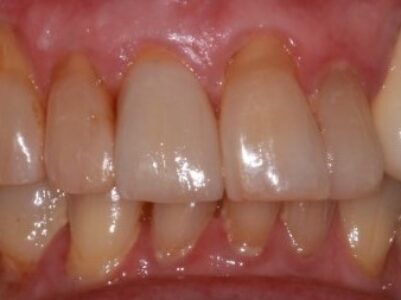 After - Brunswick Dental Practice