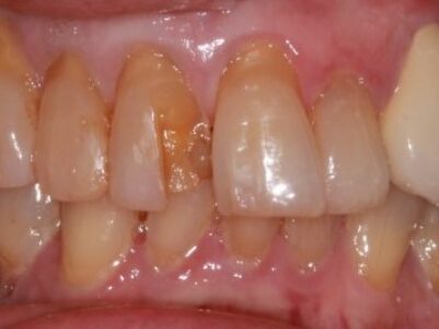 Before Face - Brunswick Dental Practice