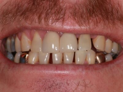 Before Face - Brunswick Dental Practice