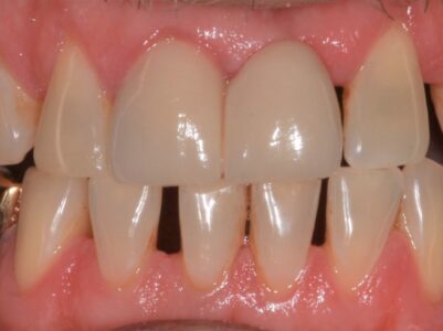 Before - Brunswick Dental Practice