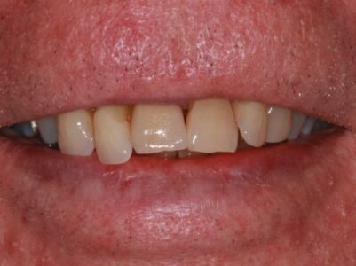 After - Brunswick Dental Practice