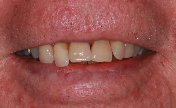 After - Brunswick Dental Practice