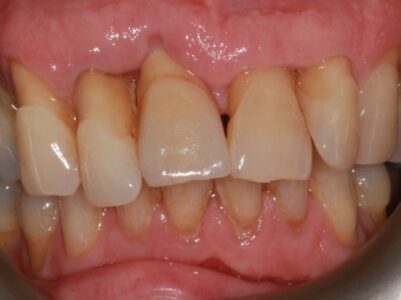 After - Brunswick Dental Practice