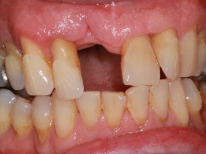 After - Brunswick Dental Practice