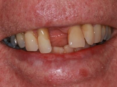 Before -Brunswick Dental Practice