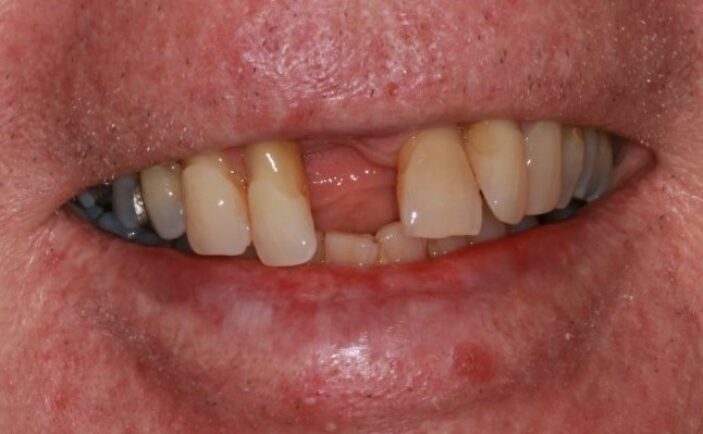 Before - Brunswick Dental Practice