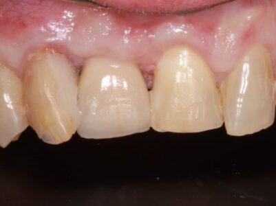 After - Brunswick Dental Practice