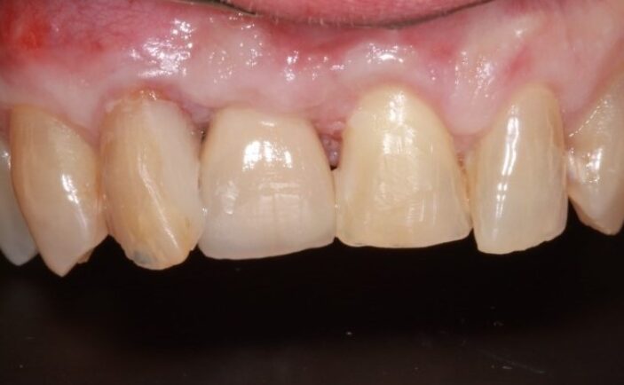 After - Brunswick Dental Practice